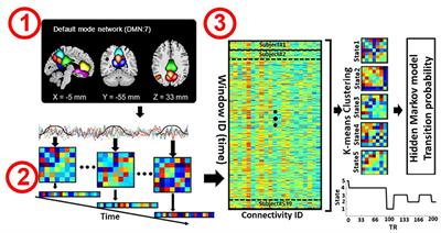 Aberrant Dynamic Functional Connectivity of Default Mode Network in Schizophrenia and Links to Symptom Severity